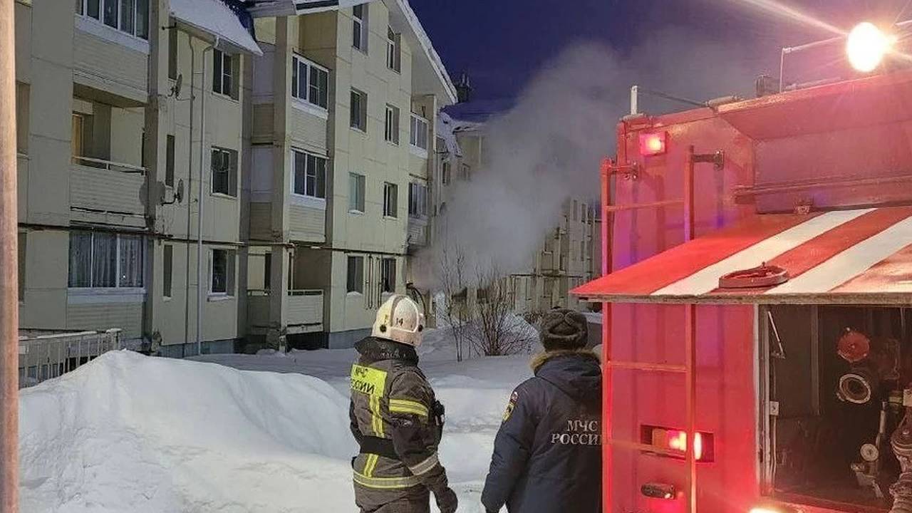 Главная картинка новости: Житель Коми сильно пострадал при пожаре