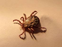 Эпидемия клещевых укусов у детей: медики Коми  выдали родителям рекомендации