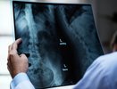 В Минздраве Коми оценили затраты на покупку и ремонт ломающихся рентгенов