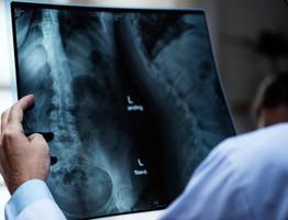 В Минздраве Коми оценили затраты на покупку и ремонт ломающихся рентгенов