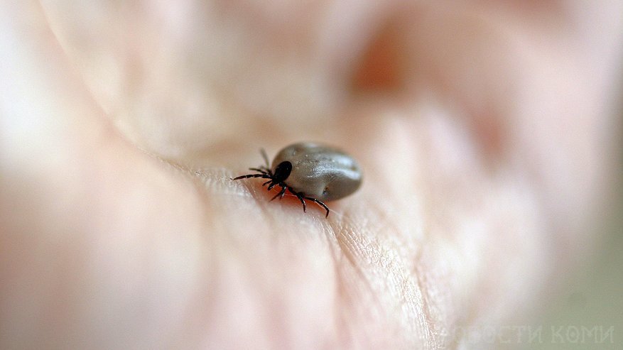 За неделю в Коми опасные паразиты напали на 219 человек