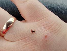 Клещи не переносят этот запах: стоит копейки, а защищает на порядок лучше любых магазинных средств