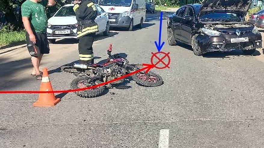 Главная картинка новости: В Коми юноша на питбайке получил переломы, столкнувшись с иномаркой