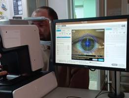 Новое уникальное оборудование появилось в Ухтинском глазном центре